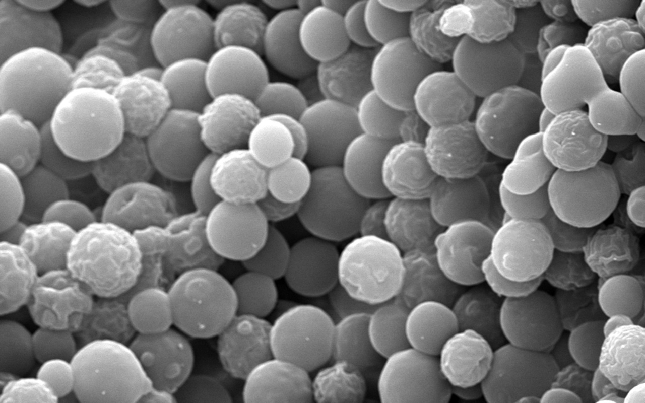 Closeup of yeast through SIU IMAGE equipment